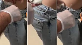 Talihsiz kadının korku dolu anları! Sivilce sandı ama gerçeği fark edince hastaneye koştu