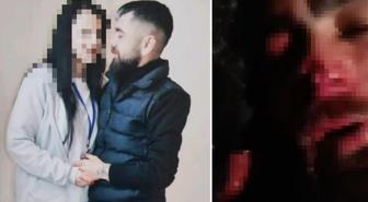 Yasak aşk dehşeti! Eski sevgilisinin ailesi işkence edip uzuvlarını kopardı