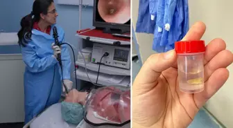 Sağ akciğeri tamamen kapandı! 5 ay önce yediği mısır tanesi az kalsın hayatından ediyordu