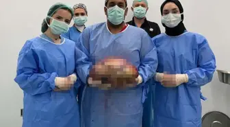 Şişlik yüzünden gitti, karnından çıkan doktorları bile şoke etti