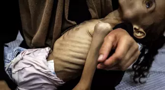 İnsanlığı utandıracak görüntüler! Gazzeli Meryem yavaş yavaş ölüyor