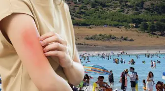 Et yiyen bakteri vakası Türkiye'de görüldü mü? Bakanlıktan açıklama