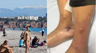 Et yiyen bakteri vakası Türkiye'de görüldü mü? Bakanlıktan açıklama