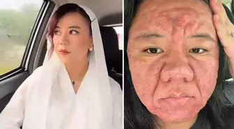 Yok böyle bir değişim: Bir anda onlarca yıl yaşlandı