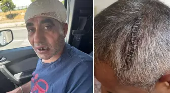 Eğlence mekanında tekme, yumruk ve sopalarla ölümüne dövüldü