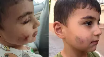 Ankara'nın göbeğinde lağım faresi uyuyan çocuğu ısırdı