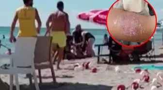 Plaj keyfi 'sigara dumanı' ile kabusa döndü, üst üste dövüşüp kolunu ısırdı