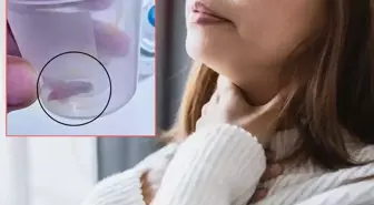 1.5 yıldır süren öksürüğünün nedeni kabak çekirdeğiymiş!
