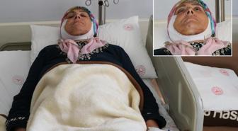 Tek ameliyatla sağlığına kavuştu, 15 yıl sonra ilk defa gülümseyebilecek