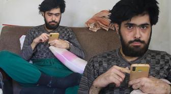3 yıldır tırnaklarını kesmeyen ve duş almayan gencin eski hali ortaya çıktı