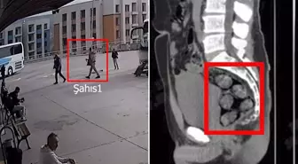 Tomografideki görüntü şoke etti! Zehir tacirleri yakayı böyle ele verdi