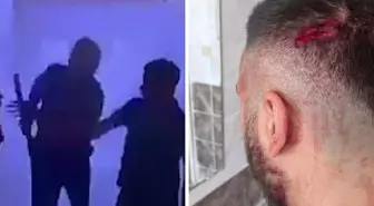 Öğretmene veliden sopalı saldırı