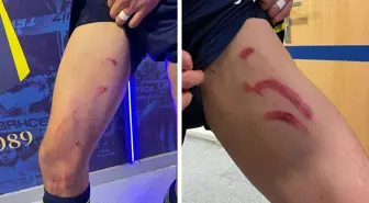 Stuttgart maçında tekme yiyen Fenerli yıldızın son hali inanılmaz