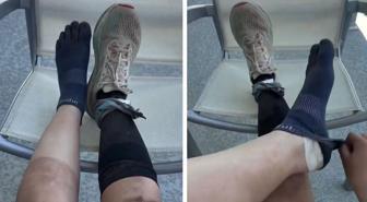 160 kilometre koşan sporcunun ayaklarının son hali inanılmaz