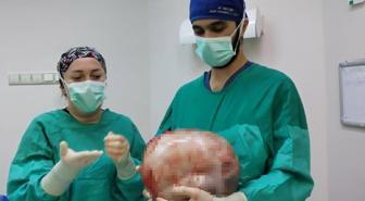 2 ayda 9 aylık hamile gibi büyüdü, doktorlar görünce apar topar ameliyata aldı