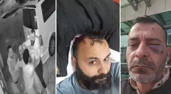 Ünlü fenomene eşi ve ailesinden öldüresiye dayak