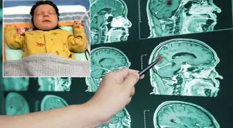 Çığır açacak adım! Beyin hasarı artık erken tespit edilebilecek