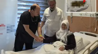Yaşlı kadının safra kesesinden 213 adet taş çıktı