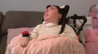 Beyinsiz doğan Alex 20 yaşında, doktorlar 5 yıl yaşamaz demişti