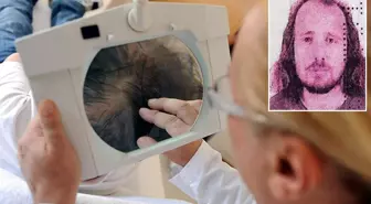 Saç ektirip diş yaptıran İngiliz aniden fenalaşarak hayatını kaybetti