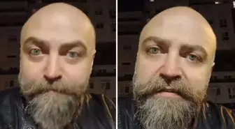 Saçsız adam isyan etti! Berbere ödediği ücret öyle böyle değil