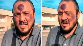 Yüzüne yaptırdığı işlemden sonra bu hale geldi, yine de savundu