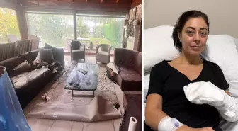 Sakın evinize sokmayın! Dekoratif olarak aldı, vücudunun yüzde 30'u yandı