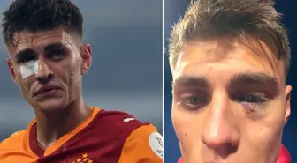 Kazımcan Karataş'a çakmak atan kişi hakkında karar çıktı