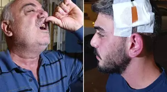 Komşu dehşeti! Babanın dişlerini kırdı, anneyle oğlunu bıçakladı