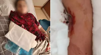 9 yaşındaki çocuk, 8 yaşındaki çocuğun kolunu kırarak intikam aldı