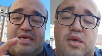 Diş tedavisi fiyatları araba fiyatını geçti!