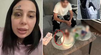 Genç kadının isyanı: Tecavüz edince evlendik, aynı gün şiddet başladı