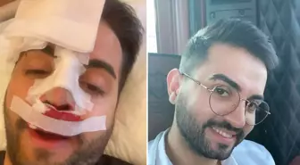 Kadir Ezildi burnu sargılı fotoğrafıyla korkuttu! Gerçek sonradan ortaya çıktı