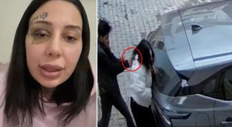 Sokak ortasında vahşet: Tecavüz etti, evlendik, şiddet başladı