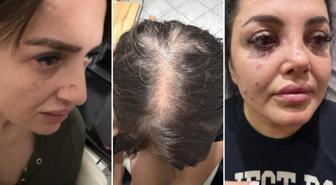 Beykoz'da dehşet anları! Ofisi basan grup eski patronlarını sokak ortasında darp etti