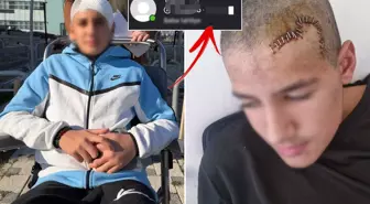 Okul arkadaşı taşla kafasını parçaladı! Tahliye edilen çocuğun paylaşımı çıldırttı