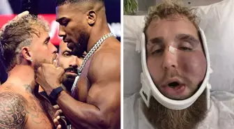 Suratı tanınmaz hale gelen Jake Paul'un ne kadar kazandığını duyunca şok olacaksınız