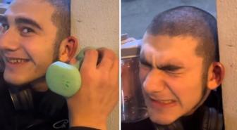 Dövüşçülere benzemek için kulak kıkırdaklarını kırdırdı