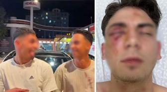 Muştalarla döverek kör ettiler, ellerinde kan ile video çektiler! 1,5 ayda tahliye olan şüpheliler yeniden gözaltında