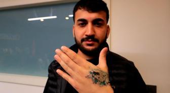 Dövme sildirmek isterken kabusu yaşadı, elindeki dokular öldü