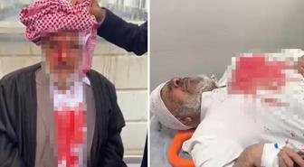 Şanlıurfa'da sopayla darba 4 tutuklama