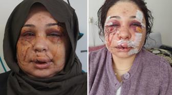 Polis eşi tarafından darbedildiği iddiasıyla şikayetçi oldu