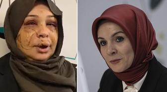 Bakan Göktaş: Şiddete uğrayan kardeşimizin yanındayız, davaya müdahil olacağız