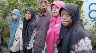 Dünya onları konuşuyor! 'Kertenkele Ailesi' kısa sürede fenomen oldu