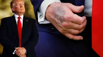 Trump elindeki morluğun nedeni açıkladı