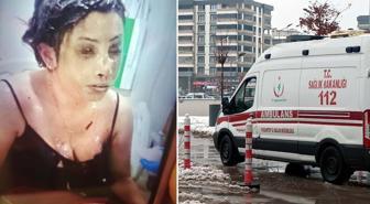 Bunun adı saf kötülük! Eşini koli bandıyla bağlayıp kezzapla yaktı