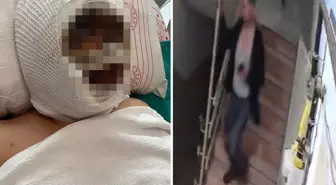 Eski eşini kezzapla ağır yaralayan adam her şeyi önceden planlamış