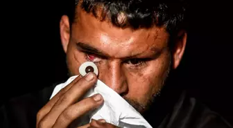 Savaşta iki kez yaralandı, gözlerini kaybetti