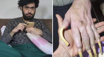 Türkiye'nin konuştuğu Barış'ın yeni işini ve son halini görenler şaşıp kalıyor