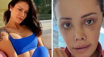 Yüz nakli yaptıran Didem Ceran'ın son hali: Harika gözüküyorum